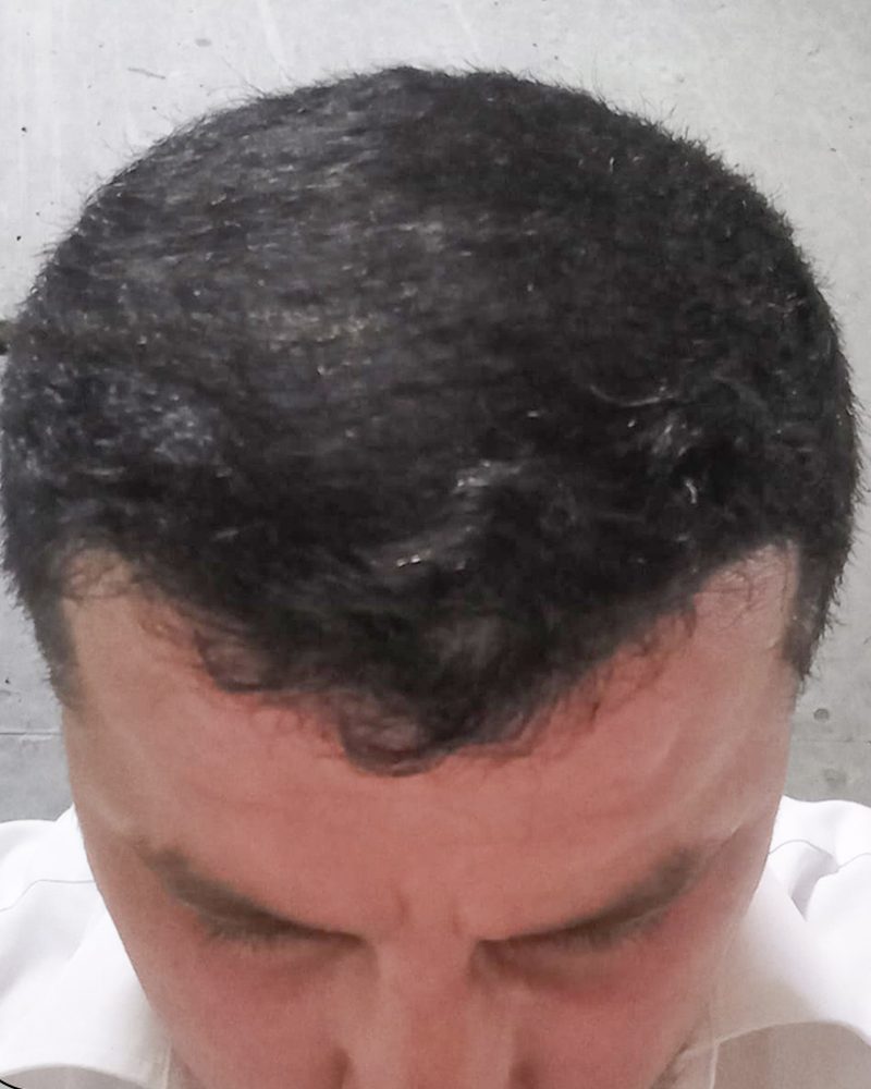 Sonrası