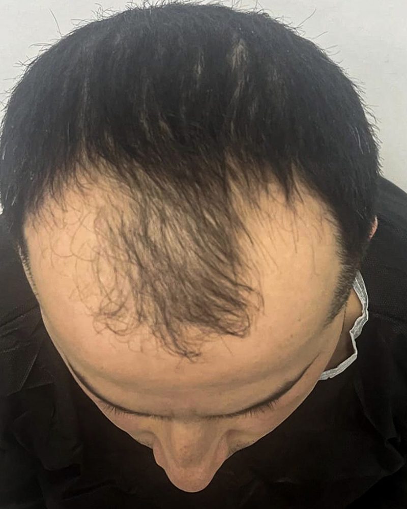 Öncesi