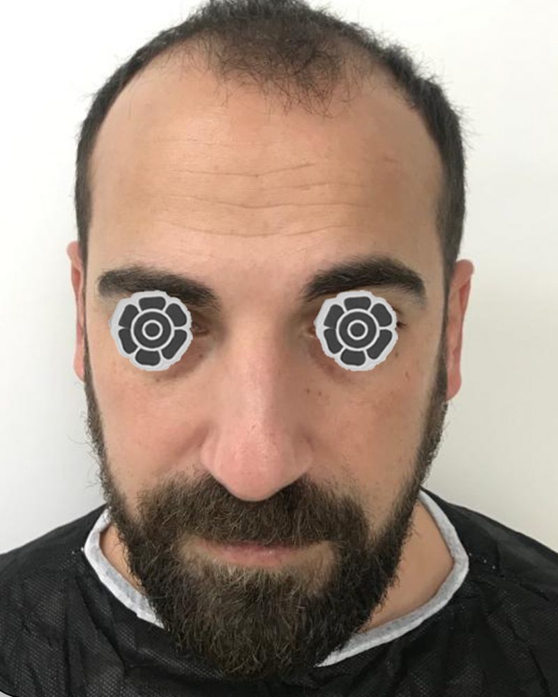 Öncesi